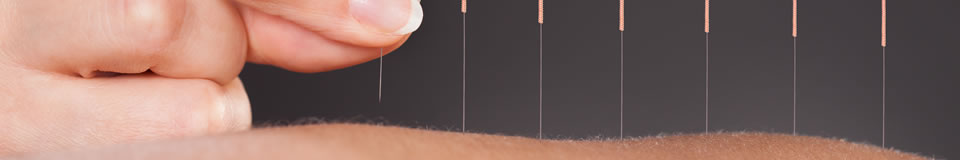 Why use Kamara Acupuncture